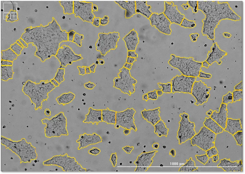 View bright-field iPSC confluence image